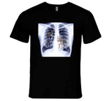 Got That Dog In Him Xray Meme T Shirt